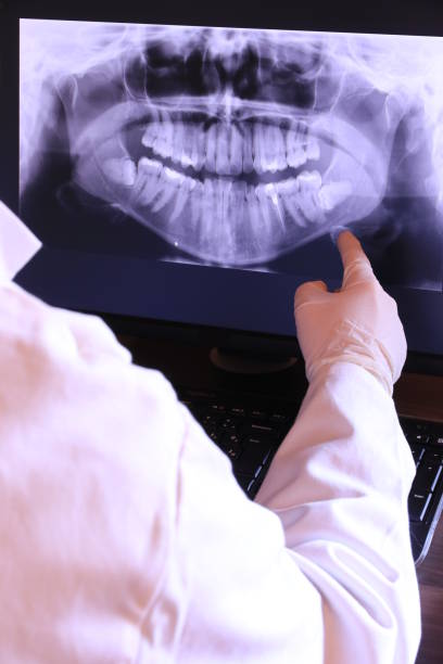 Best Dentist for Tooth Abscess  in Myers Corner, NY